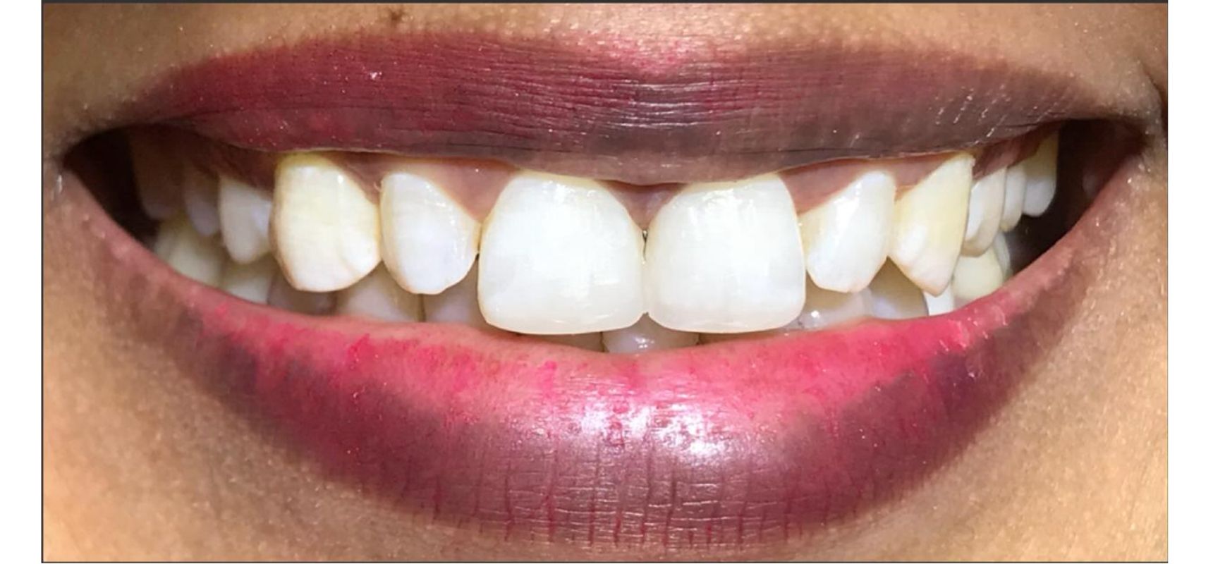 Before & After Images Sadiq Sharaf Dental Center